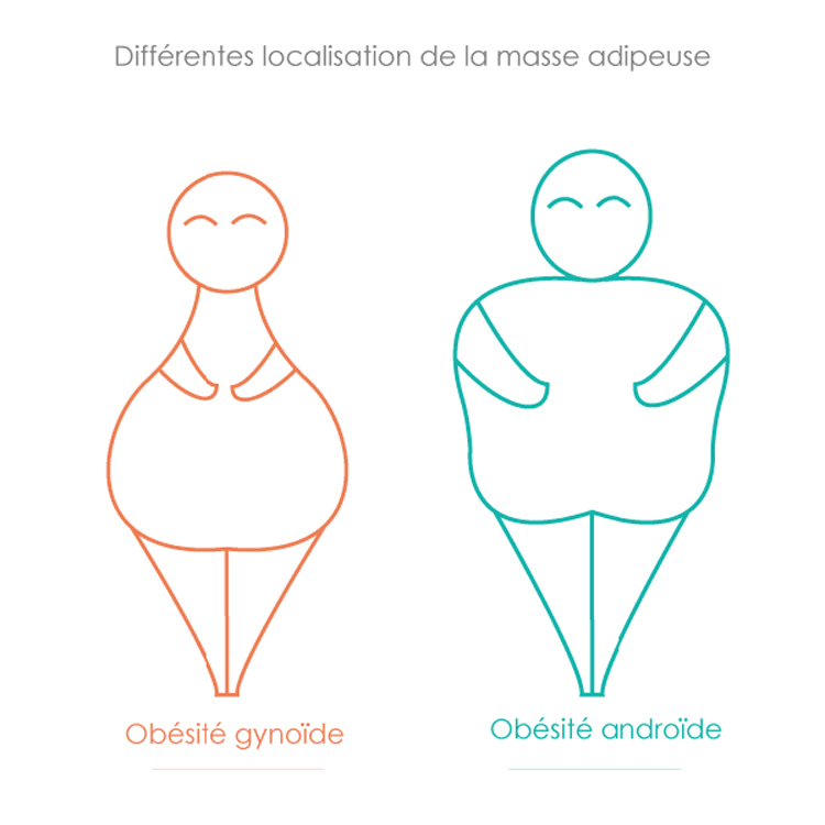 Localisation masse adipeuse